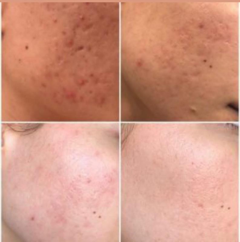 اسکراب و لایه بردار شیر گاو ایمیجز