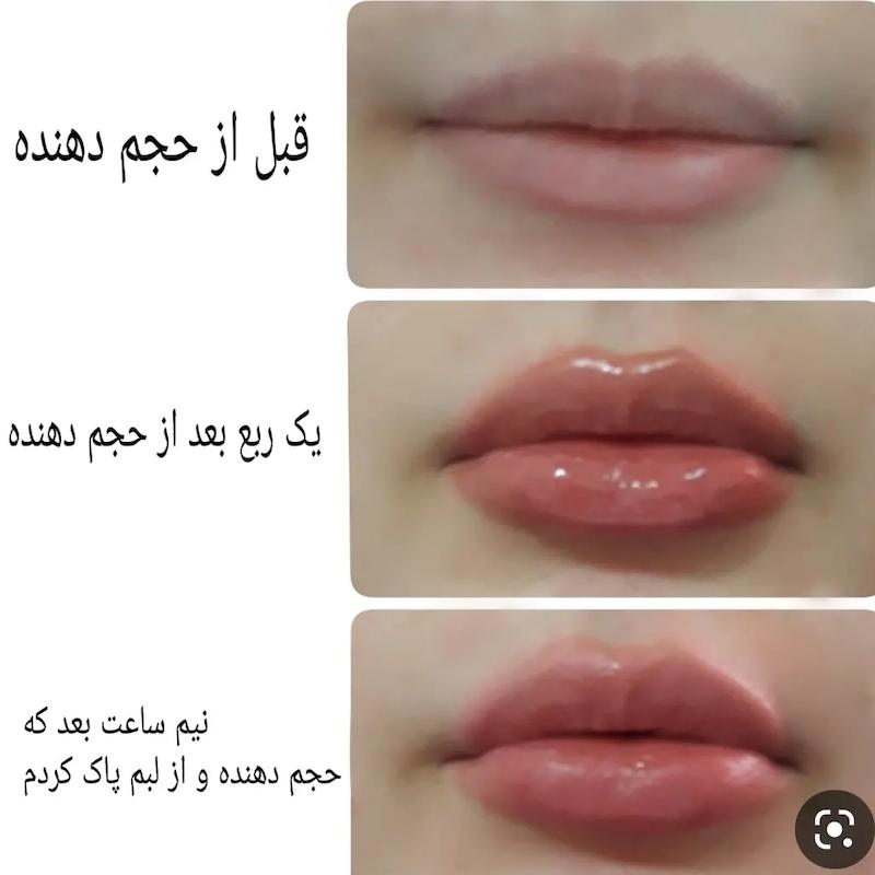 حجم لب امپولی