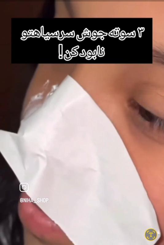 چسب لانبنا اورجینال