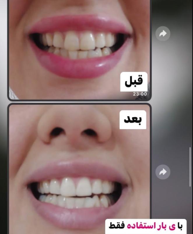 قطره سفید کننده دندان لانبنا Lanbena