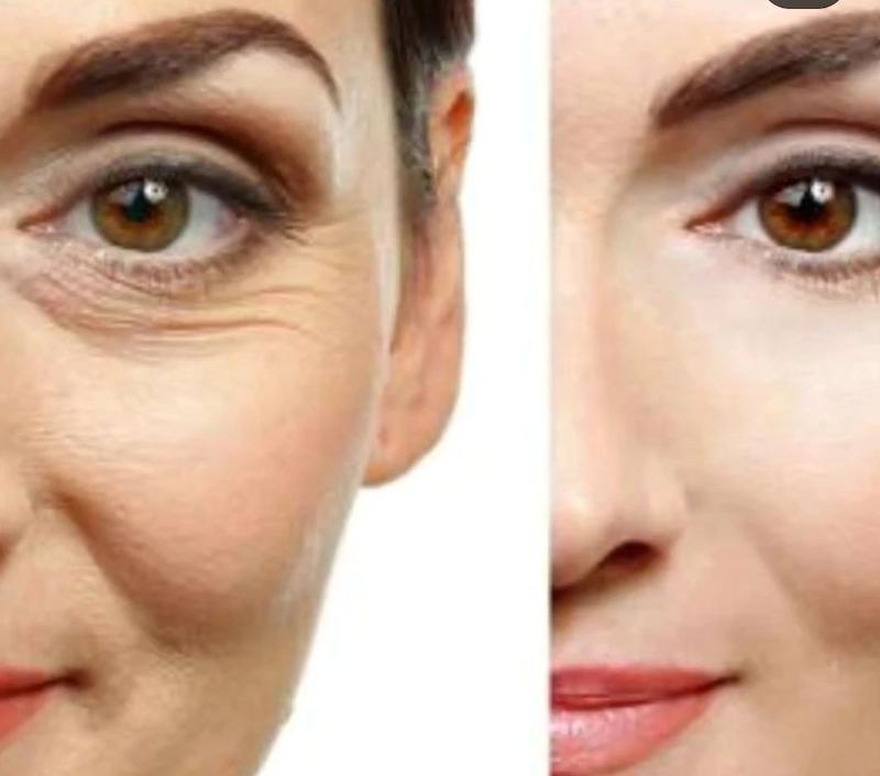 ماسک بوتاکس شراب جومتام