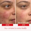 مرطوب کننده فرست اید بیوتی 