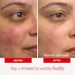 مرطوب کننده فرست اید بیوتی 