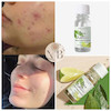 روغن پاکسازی کننده و ضدجوش تی تری و لیمو لاونیچر اوریفلیم