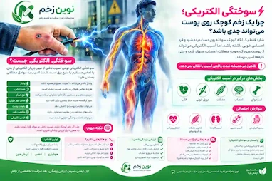 سوختگی الکتریکی؛ چرا یک زخم کوچک روی پوست می‌تواند جدی باشد؟