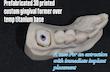 شابلون سیلیکونی ساخت کاستومایز هیلینگ و اباتمنت و ... فرم‌دهنده لثهٔ (gingival former)
