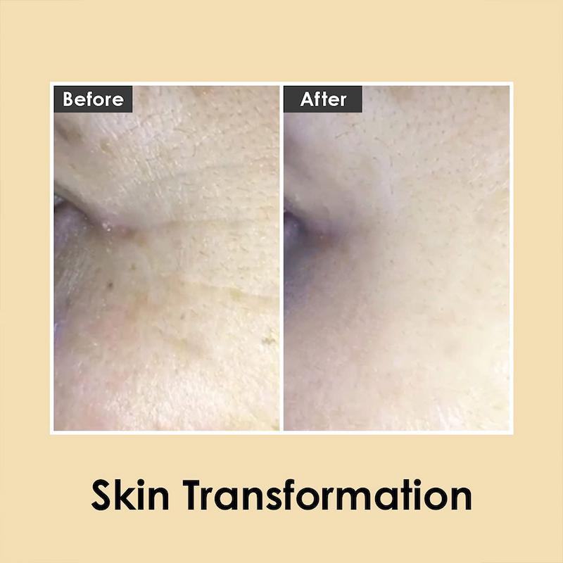 کرم دور چشم ۹ پپتید و هیالورونیک اسید مدی پیل | Medipeel 9 Peptide & Hyaluronic Acid Eye Cream