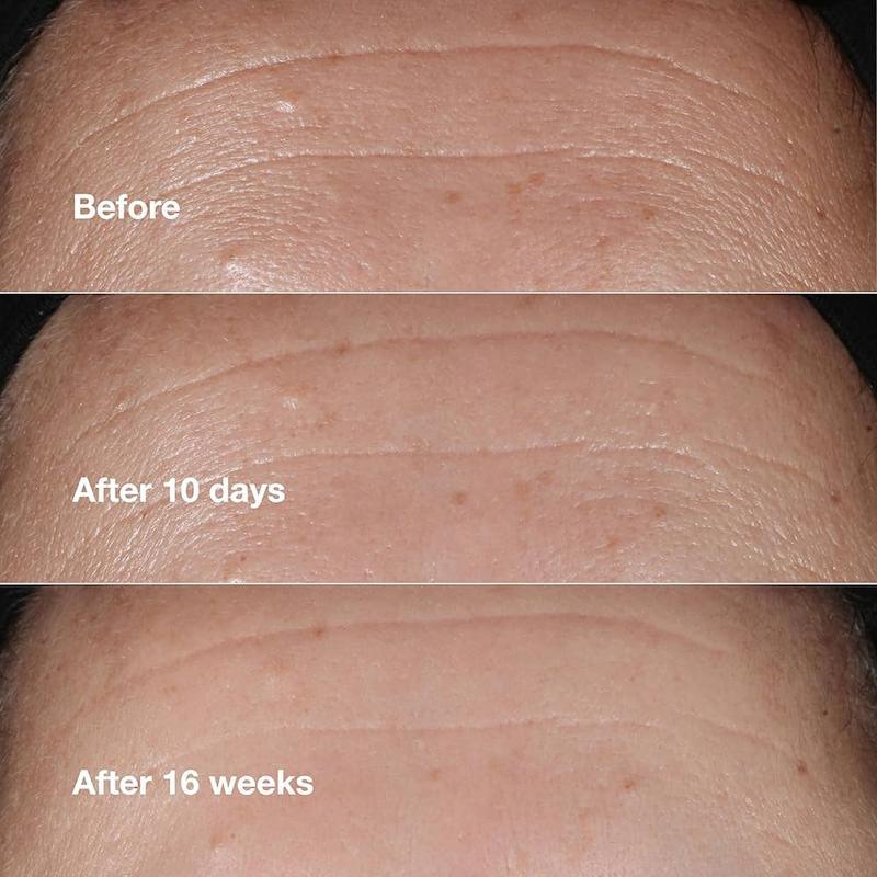 سرم ضدچروک و ترمیم‌کننده کلینیک مدل Smart Clinical Repair Wrinkle Correcting Serum