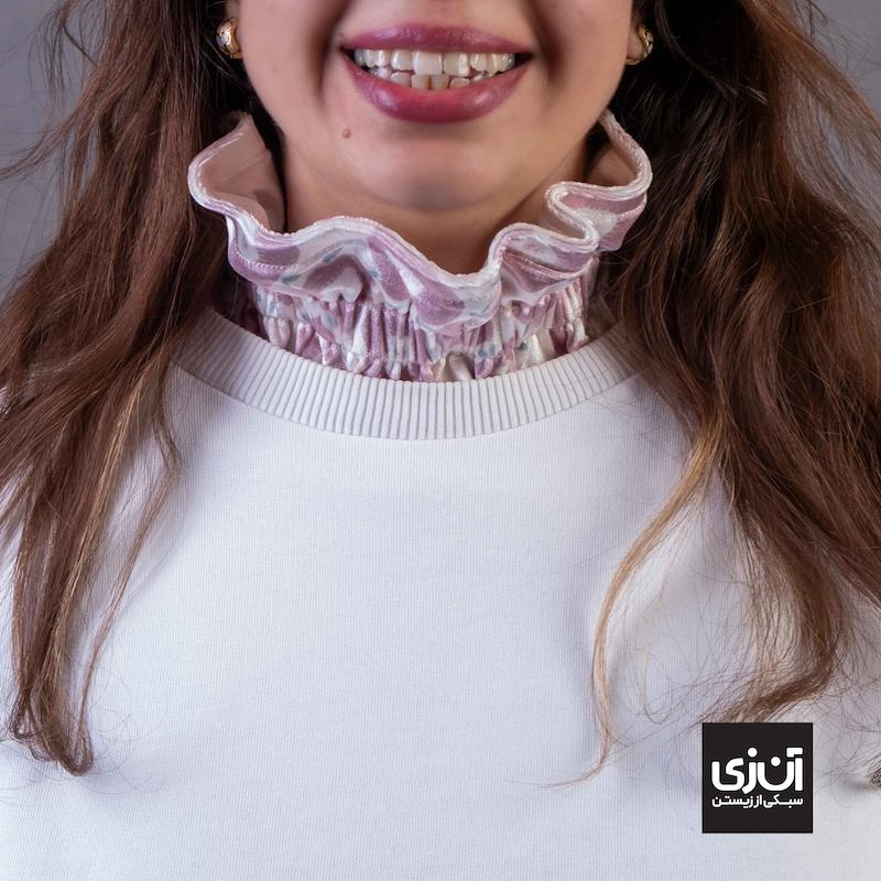 یقه ویکتوریایی