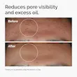 سرم نیاسینامید اوردینری 10% + زینک 1% 