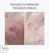 بوستر لایه‌بردار گلیکولیک اسید آرنسیا ضدجوش و کنترل چربی/Arencia  Eraser Shot Glycolic Acid Booster Cream with BHA for Texture Refining and Pore Care for Acne-Prone Skin