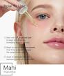 سرم آزلائیک اسید ۱۰٪ و هیالورونیک اسید آنوا مدل Azelaic Acid 10 Hyaluron Redness