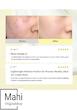 کرم ترمیم‌کننده و تسکین‌دهنده پوست دکتر آلتیا مدل 345 Relief Cream