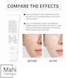 کرم ترمیم‌کننده و تسکین‌دهنده پوست دکتر آلتیا مدل 345 Relief Cream