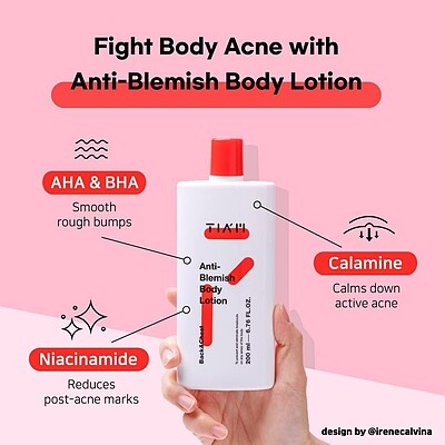 لوسیون ضد جوش و ضد لک بدن تیام TIAM Anti Blemish Body Lotion