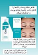 🎀سرم رتینول بازسازی و ترمیم کننده پوست سراوی    Cerave Resurfacing Retinol Serum