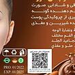 شکلات چاقی صورت طب صحراوی 
