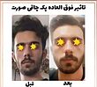 پودر جوانه گندم لیفت وپُرکننده صورت (,چاقی صورت)اصلی 