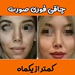 پودر جوانه گندم لیفت وپُرکننده صورت (,چاقی صورت)اصلی 