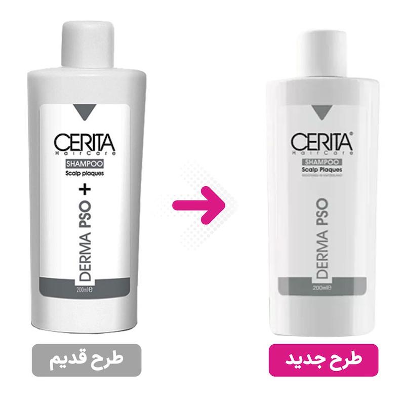 شامپو کف سر پوسته دار آنتی پسوریازیس انواع مو سریتا (200 گرم)