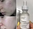 سرم نیاسین 10٪ زینک 1٪ اوردینری The Ordinary Niacinamide 10%+ Zinc 1%