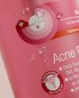 فوم شستشوی صورت صورتی نو آکنه No Acne، مناسب پوست نرمال و چرب، حجم 150 میلی لیتر