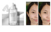 آمپول (سرم) روشن کننده و کوچک کننده منافذ سنتلا Skin 1004 Brightening Ampoule 