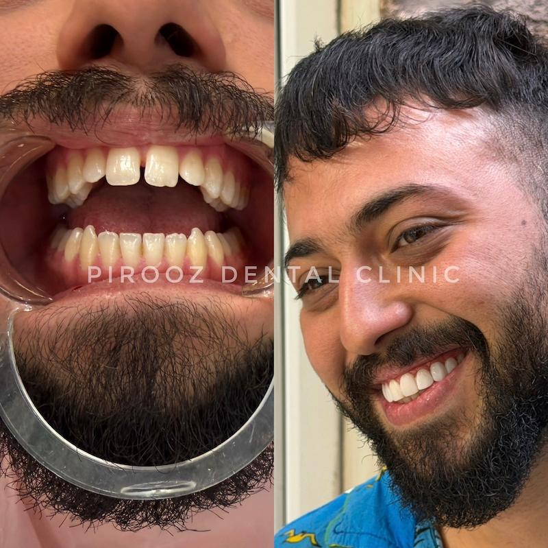 کامپوزیت زیبایی کاریزما