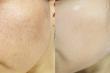 تونر حذف کننده منافذ بی د اسکین  Be The Skin BHA+ Pore Zero Toner