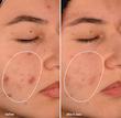 سرم کنترل منافذ و جوش سالیسیلیک اسید 2% سلوشن اوردینری  The Ordinary Salicylic Acid 2% Solution