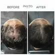 سرم ویال ضد ریزش درمانی فیتو سیان مخصوص آقایان تحریک رشد و ضخامت مو  PHYTOCYANE ANTI HAIR LOSS TREATMENT FOR MEN