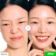 سرم تسکین دهنده و ترمیم کننده قوی PDRN و آلوئه ورا اکوال بری  EQQUAlBERRY Aloe PDRN Calming Serum