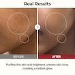 تونر پیل شات برنج دکتر ملاکسین  Dr.Melaxin Peel Shot Glow Rice Toner