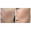 آمپول تسکین دهنده سنتلا ماداگاسکار SKIN1004  SKIN1004 MADAGASCAR CENTELLA ASIATICA 100 AMPOULE