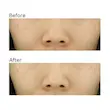 کرم ضد لک جای جوش و روشن کننده یوجا نیاسین سام بای می  SOME BY MI Yuja Niacin Anti Blemish Cream