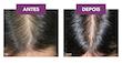 مکمل فیتوسیان مخصوص ریزشهای ارثی و هرمونی  PHYTO Phytocyane Queda Cabelo