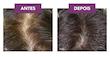 مکمل فیتوسیان مخصوص ریزشهای ارثی و هرمونی  PHYTO Phytocyane Queda Cabelo