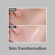 پد تونر تنگ کننده منافذ و جوانساز کلاژن مدی پیل  MEDI-peel RED LACTO COLLAGEN DOUBLE TIGHT PAD