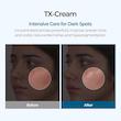 کرم ترانگزامیک اسید دکتر ملاکسین تی ایکس برای کک و مک، لکه‌ها  Dr.Melaxin Tx Tranexamic Acid Cream
