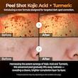 سرم پیل شات کوجیک اسید و زردچوبه دکتر ملاکسین لایه بردار ملایم و روشن کننده  dr melaxin peel shot exfoliating kojic acid turmeric serum