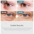 کرم دور چشم دبل ضد تیرگی و ضد چروک قوی دکتر ملاکسین  Dr.Melaxin TX Tranexamic Acid Retinalsome Dual Eye Cream