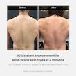شوینده بدن ضدجوش مدیکوب پاکسازی عمیق و کنترل آکنه بدن  Medicube RED ACNE BODY WASH