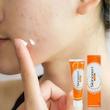 کرم آزلائیک اسید اسکینورن درمان آکنه، لک و جای جوش  Skinoren 20% Azelaic Acid