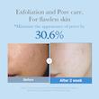 تونر کوچک کننده منافذ و لایه بردار مدیکوب  Medicube Zero Pore Exfoliating & Hydrating Toner