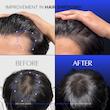 سرم اسکالپ محرک رشد مو لیلیوئه  مدل پرایم  Lilyeve GROW:TURN EXOSOME Brush Ampoule Prime