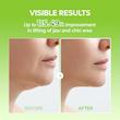 ماسک لیفت‌کننده (V-Up) گونه و غب‌غب کاکتوکس دکتر ملاکسین – ۴ عددی  Dr. Melaxin Cactox Cooling V-Up Mask – 4 pcs