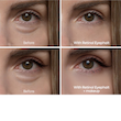 کرم دورچشم ضدپف و کیسه زیرچشمی ایفالت دکترملاکسین حاوی رتینول  Dr.Melaxin Eyephalt Retinol Eyebag Cream -10ml