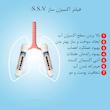 دستگاه تصفیه کننده آب اس اس وی مدل MaxGold N 2W X1055 +3F به همراه شیر دوکاره و فیلتر