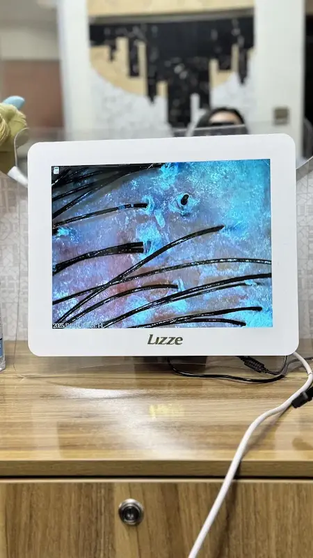 آنالیز ۱۵ اینچ لیز Lizze مجهز به هوش مصنوعی باگارانتی اصالت و سلامت کالا