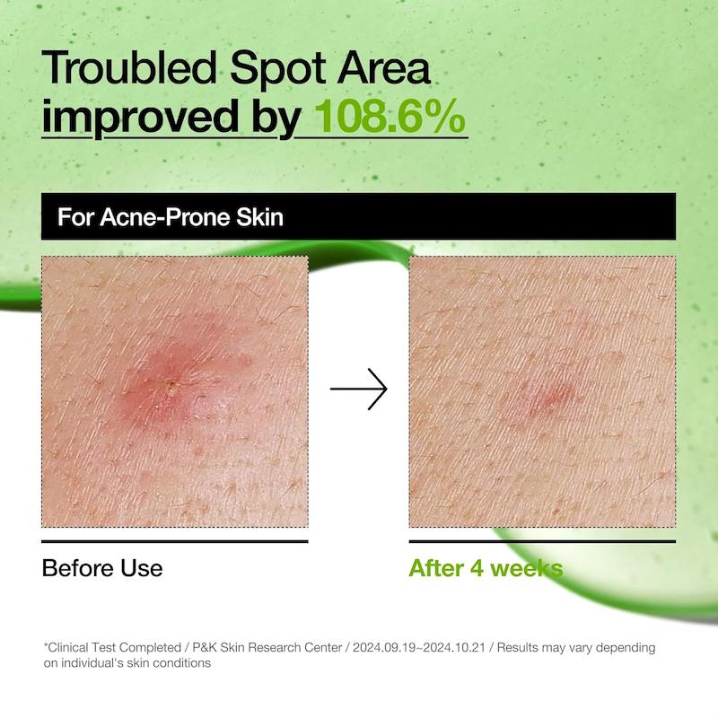 سرم پوستی برند Anua مدل Anua Azelaic Acid 10 Hyaluron